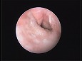 洗浄後……耳道の奥に小さな鼓膜が観察される