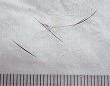 脆弱な鼓膜（?）が確認される