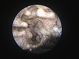 腫れがひいた耳介