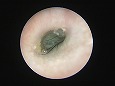 鼓膜外側面手前に多数の黒色の毛がみえる