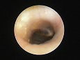 ツチ骨柄が確認できる!