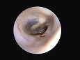 鼓膜外側面手前に多数の黒色の毛がみえる