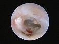 ツチ骨柄が確認できる!